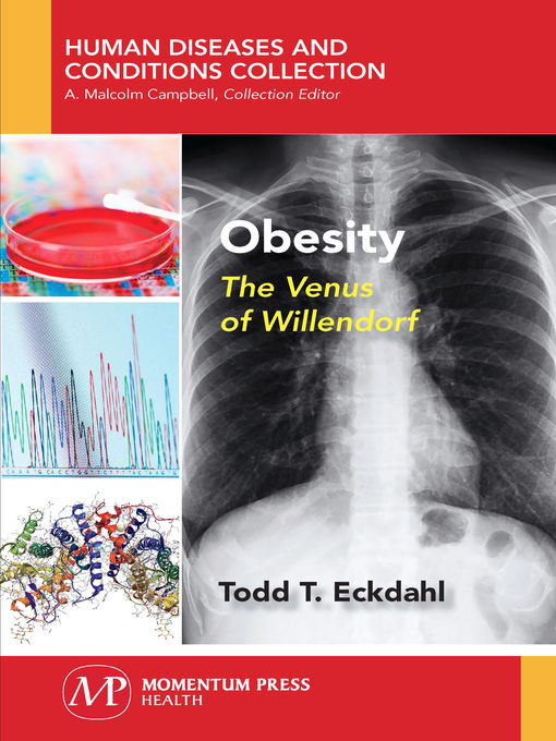 Title details for Obesity by Todd T. Eckdahl - Available